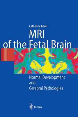 [预订]MRI of the Fetal Brain