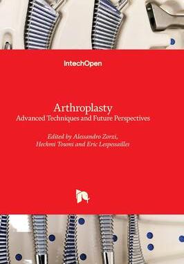 [预订]Arthroplasty - Advanced Techniques And Future Perspectives 9781803564012