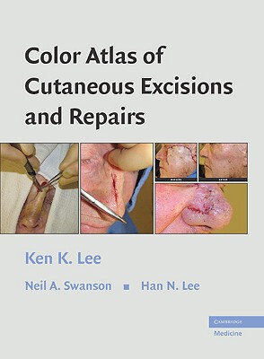【预订】Color Atlas of Cutaneous Excisions and Repairs