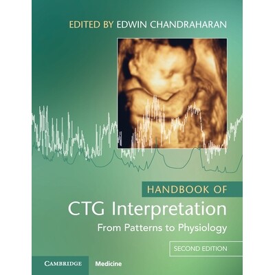 预订 Handbook of CTG Interpretation From Patterns to Physiology 胎心监护判读手册:从模式到生理 9781009322300