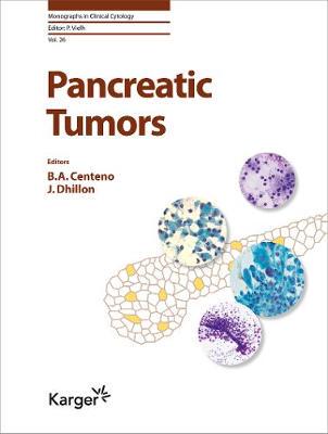 【预订】Pancreatic Tumours 9783318066036