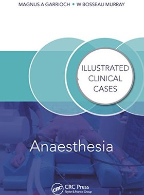 【预订】Anaesthesia