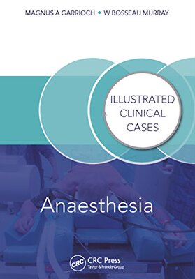 【预订】Anaesthesia