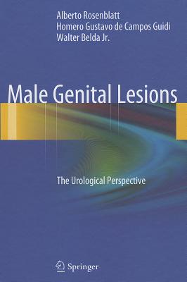 【预订】Male Genital Lesions