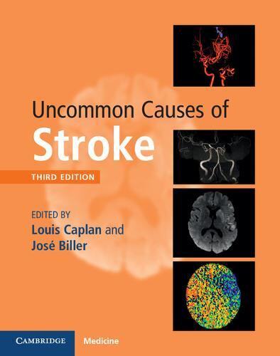预订 Uncommon Causes of Stroke