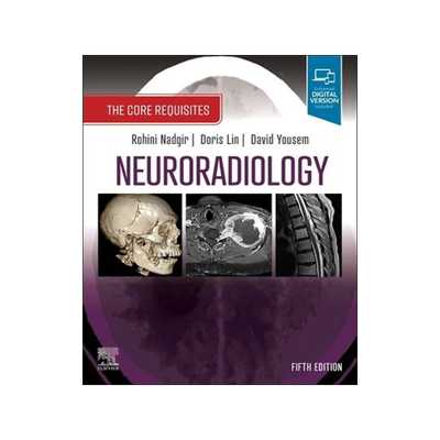 [预订]Neuroradiology 9780323759755