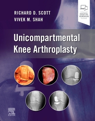 【预订】Unicompartmental Knee Arthroplasty 9780323790109