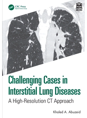 预订 Challenging Cases in Interstitial Lung Diseases: A High-Resolution CT Approach 间质性肺疾病的疑难病例：高分辨率CT方