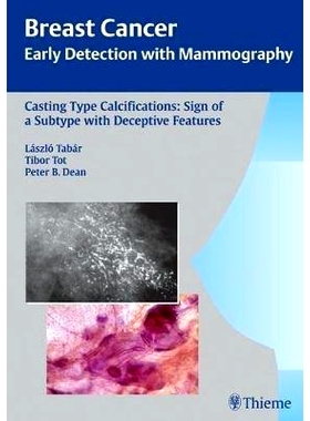 预订 Casting-Type Calcifications: Sign of a Subtype with Deceptive Features 铸造型钙化：一种欺骗性的功能型标志: 97831313