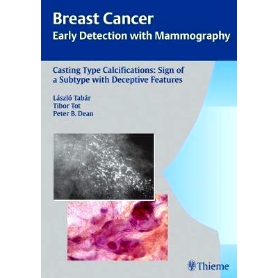 预订 Casting-Type Calcifications: Sign of a Subtype with Deceptive Features 铸造型钙化：一种欺骗性的功能型标志: 97831313