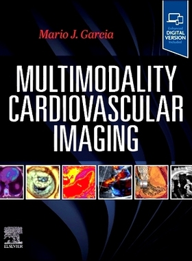 预订 Multimodality Cardiovascular Imaging: 9780443115141