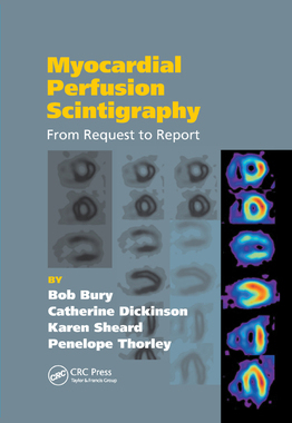 【预订】Myocardial Perfusion Scintigraphy: From Request to Report