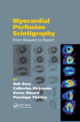 【预订】Myocardial Perfusion Scintigraphy: From Request to Report