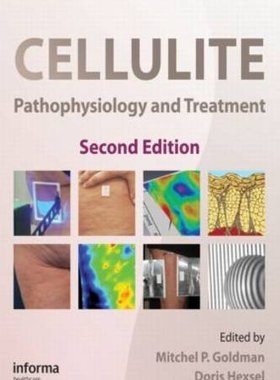 【预订】Cellulite