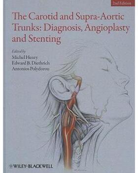 【预订】The Carotid and Supra-Aortic Trunks - Diagnosis, Angioplasty and Stenting