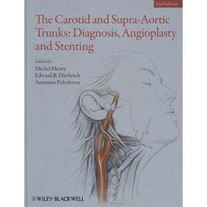 【预订】The Carotid and Supra-Aortic Trunks- Diagnosis, Angioplasty and Stenting