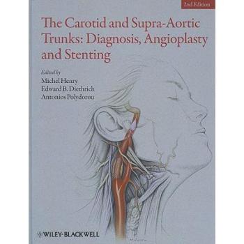 【预订】The Carotid and Supra-Aortic Trunks - Diagnosis, Angioplasty and Stenting