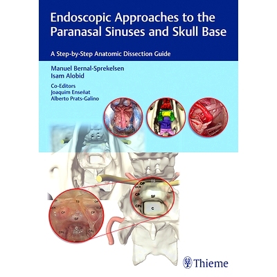 预订 Endoscopic Approaches to the Paranasal Sinuses and Skull Base: A Step-by-Step Anatomic Dissection Guide 对鼻窦、颅