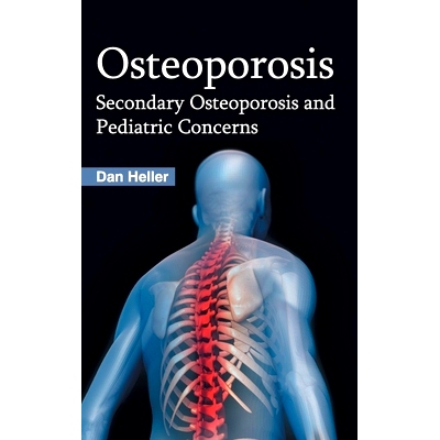 预订 Osteoporosis: Secondary Osteoporosis and Pediatric Concerns 骨质疏松症：继发性骨质疏松症和小儿问题: 9781632423061