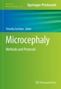 【预订】Microcephaly: Methods and Protocols 9781071627518