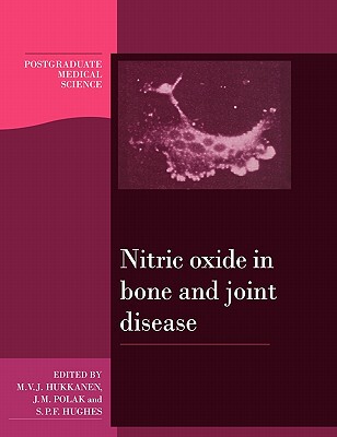 【预订】Nitric Oxide in Bone and Joint Disease