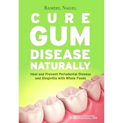 预订 Cure Gum Disease Naturally: Heal Gingivitis and Periodontal Disease with Whole Foods: 9780982021361