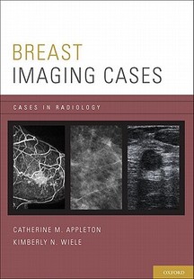 Imaging Breast Cases 预售