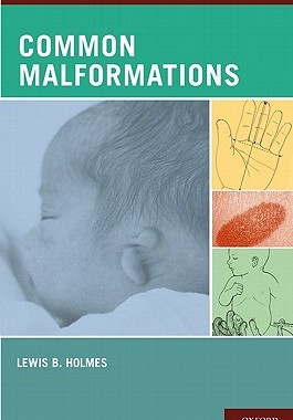 【预订】Common Malformations