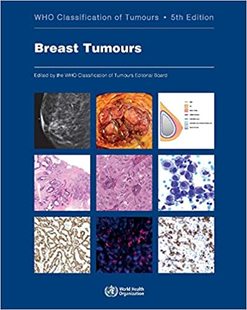 预订 Tumours Breast