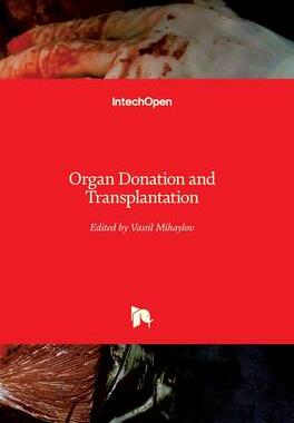 [预订]Organ Donation and Transplantation 9781839625312