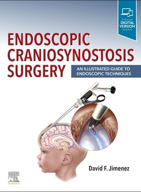 【预订】Endoscopic Craniosynostosis Surgery: An Illustrated Guide to Endosco 9780323721752