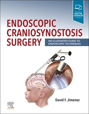 【预订】Endoscopic Craniosynostosis Surgery: An Illustrated Guide to Endosco 9780323721752