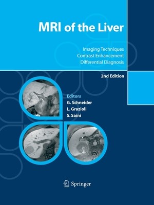 【预订】MRI of the Liver