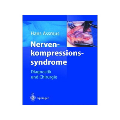 预订 Nerven-kompressions-syndrome