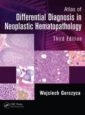 【预订】Atlas of Differential Diagnosis in Neoplastic Hematopathology, Third Edition
