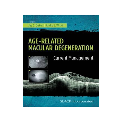 [预订]Age-Related Macular Degeneration 9781617116421