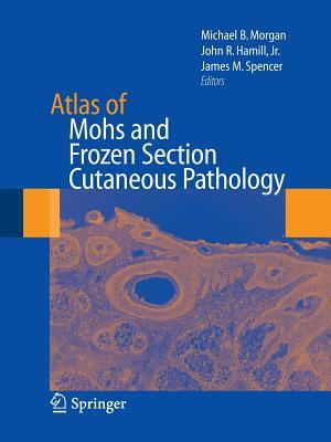 【预订】Atlas of Mohs and Frozen Section Cutaneous Pathology
