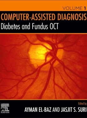 【预订】Diabetes and Fundus Oct
