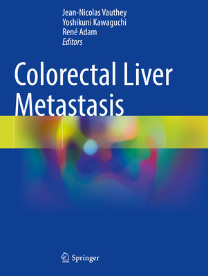 预订 Colorectal Liver Metastasis