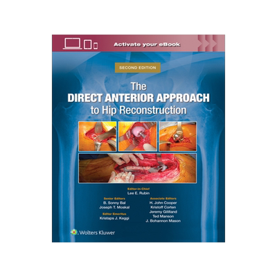 预订 The Direct Anterior Approach to Hip Reconstruction