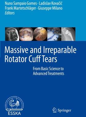 预订 【】Massive and Irreparable Rotator Cuff Tears 9783662611647
