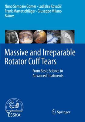 预订 【】Massive and Irreparable Rotator Cuff Tears 9783662611647