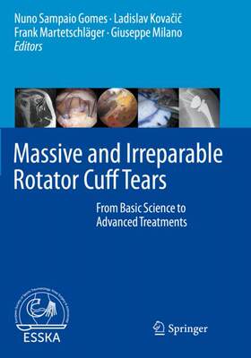 【预订】Massive and Irreparable Rotator Cuff Tears 9783662611647