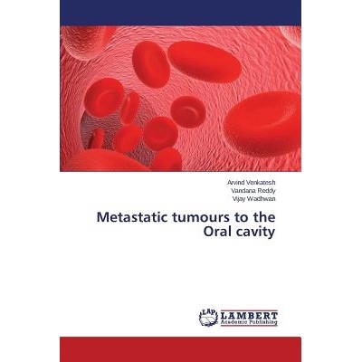 预订 Metastatic tumours to the Oral cavity 转移性肿瘤的口腔: 9783659524400