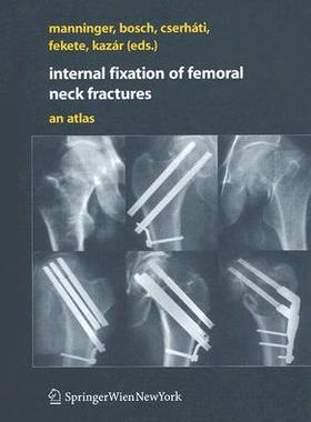 【预订】Internal fixation of femoral neck fractures