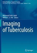 [预订]Imaging of Tuberculosis 9783031070426