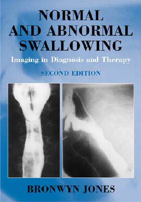 【预订】Normal and Abnormal Swallowing