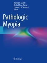 【预订】Pathologic Myopia 9783030743369