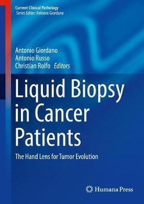 【预订】Liquid Biopsy in Cancer Patients