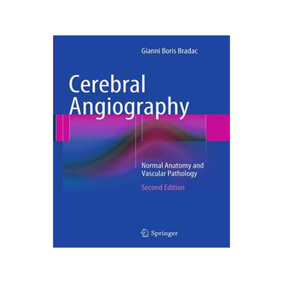 预订 Cerebral Angiography